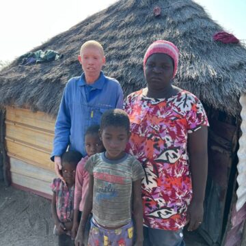 albino Ta hepekwa momukunda wavo molwoulema woshipa ‘Onda kufilwa ondjebo oikando aishe itatu shaashi ame ekishi’