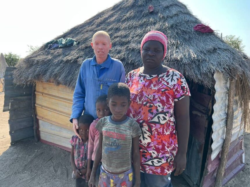 albino Ta hepekwa momukunda wavo molwoulema woshipa ‘Onda kufilwa ondjebo oikando aishe itatu shaashi ame ekishi’