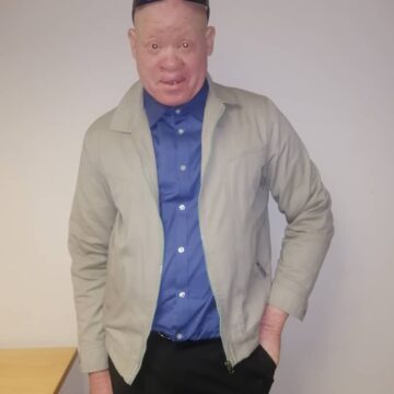 albinos Ovanaulema voshipa va halulwa koukongo weexwiki noipanyala