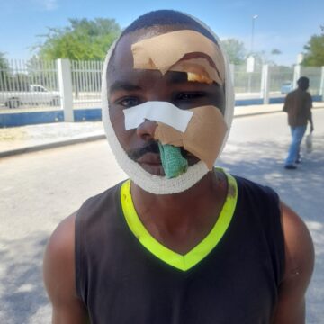 angolan shot Angolan consulate demands justice for Oshikango assault victim