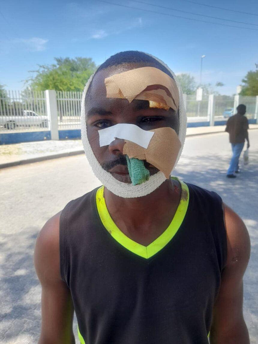 angolan shot Angolan consulate demands justice for Oshikango assault victim