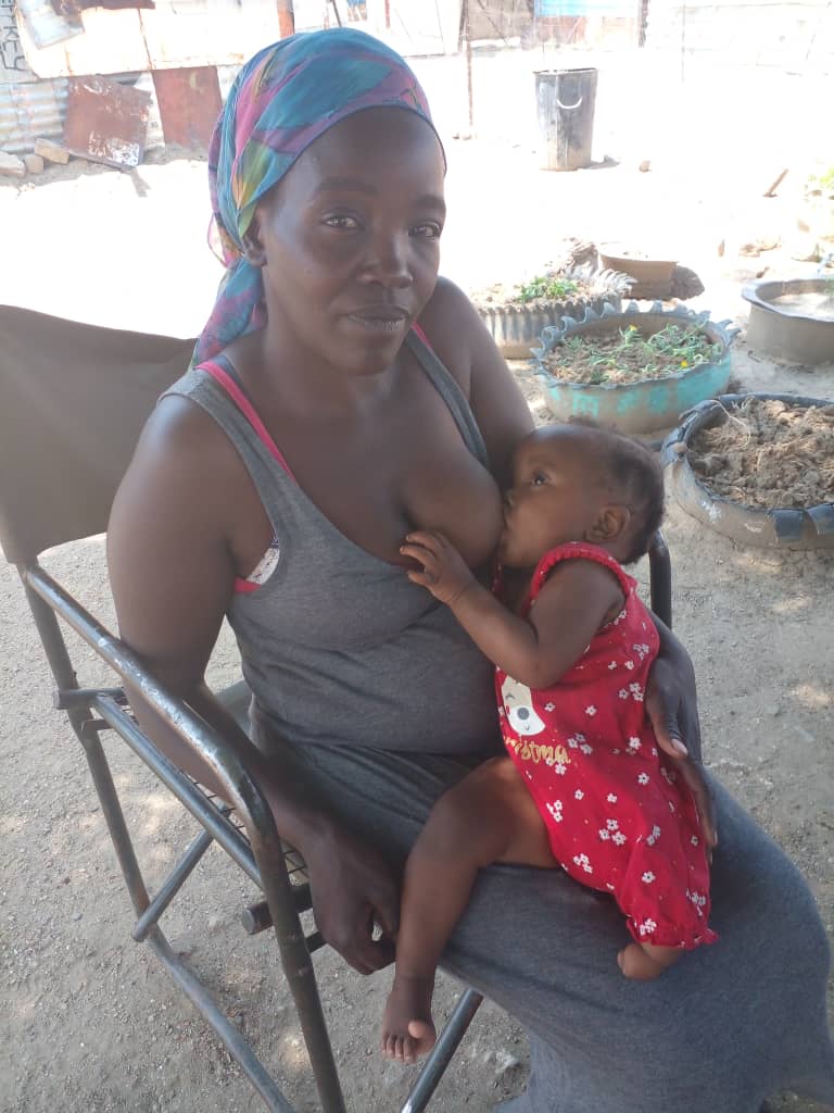 baby 1 Mother seeks help for baby born without leg