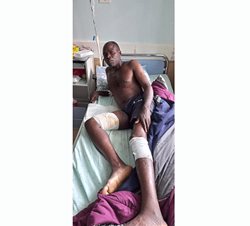 croc 1 Rundu man survives croc attack