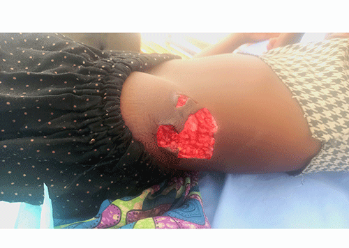 croc Brother wrestles croc to save sister