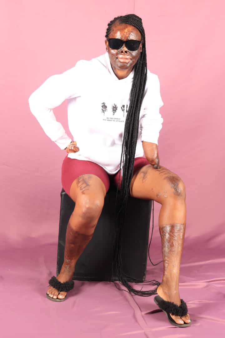 hilda 2 Fire victim demands justice