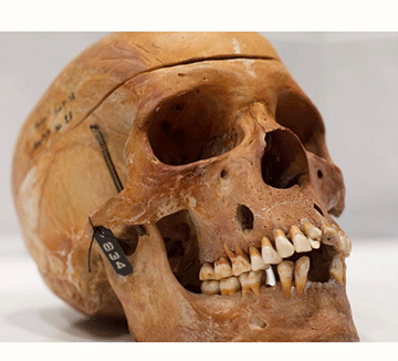 human remains French university to return human remains