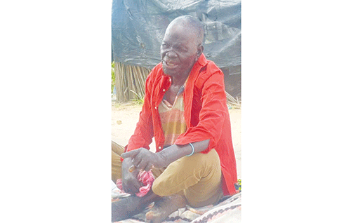 leprosy 2 Namibia in the elimination phase of leprosy