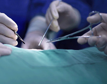 male circumcision 2 Smart cut figures rising