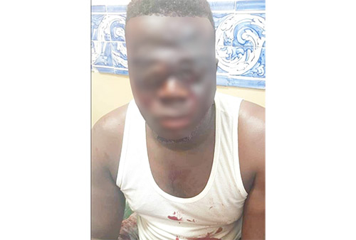 ne 20230918 03 Namibian man robbed, eyes removed in SA