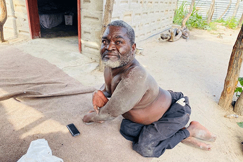 samaritans 2 Donations roll in for polio survivor