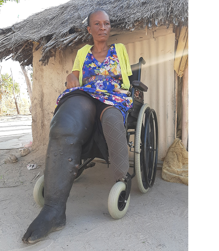 snake bite Snakebite torments woman