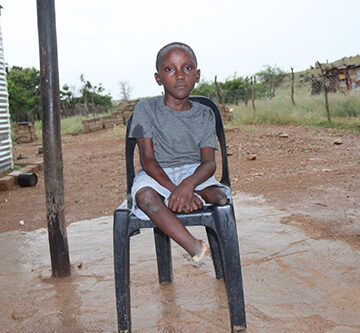 spina bifida Raising a child with spina bifida