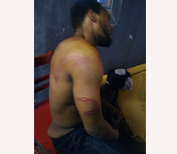 thomas Thomas sues over alleged prison assault