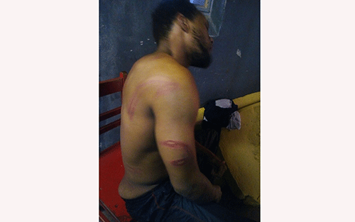 thomas Thomas sues over alleged prison assault