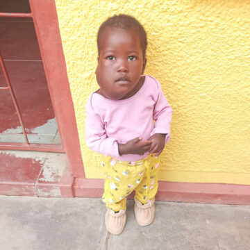 tumor1 Baby with life-threatening tumour needs help