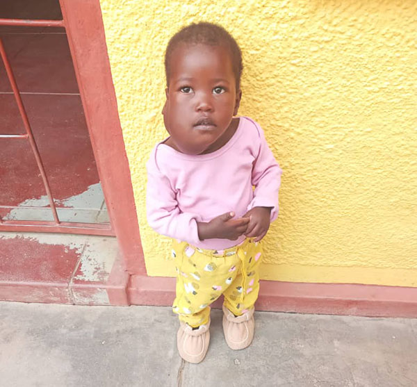 tumor1 Baby with life-threatening tumour needs help