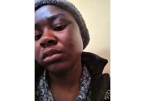 vetkoek Omukainhu a dengwa komuhona waye molwaashi vati ina teleka oukuki