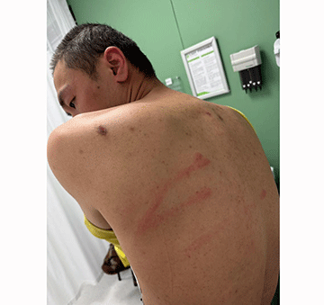 Chinese accused claims assault in custody