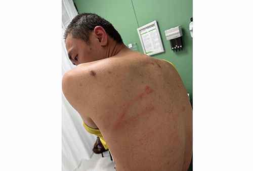 zheng 3 Chinese accused claims assault in custody