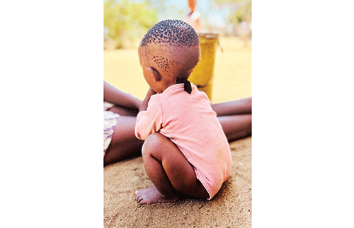 0Stunting Malnutrition stunts childrenís growth