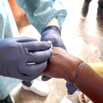 TOPSHOT-DRCONGO-HEALTH-VIRUS-MPOX No need for panic amid mpox scare ñ Shangula … truck drivers advised to get vaccinated