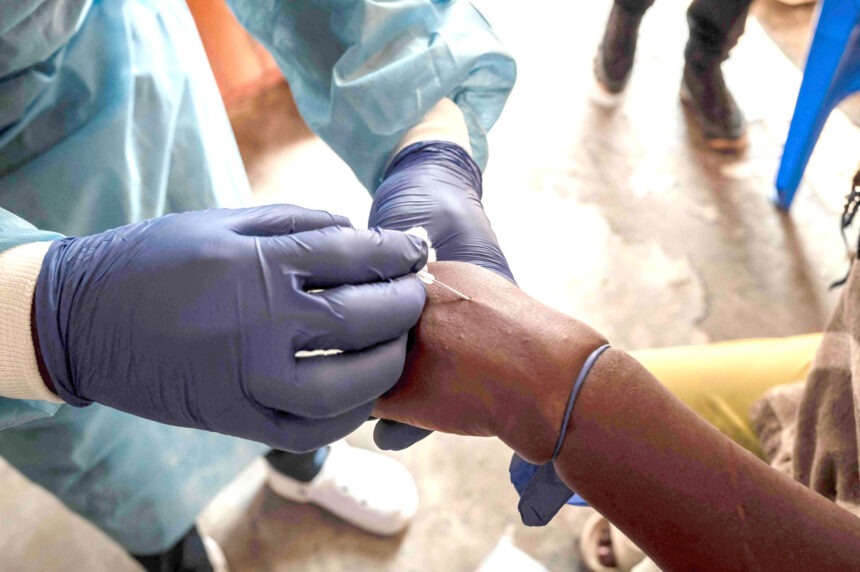 TOPSHOT-DRCONGO-HEALTH-VIRUS-MPOX No need for panic amid mpox scare ñ Shangula … truck drivers advised to get vaccinated