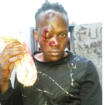 prisoners beatten Ovanadolongo (8) vati va monifwa oiponga kovapolifi …Paife ova tambulilwa moshipangelo