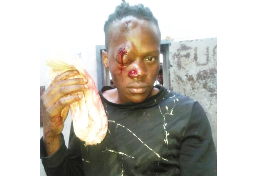 prisoners beatten Ovanadolongo (8) vati va monifwa oiponga kovapolifi …Paife ova tambulilwa moshipangelo